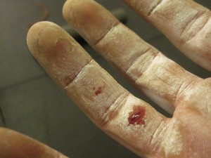 Ripped Hand from Deadlifts